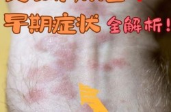 重庆首次出现四代感染病例是哪一年，重庆有多少人感染艾滋病毒