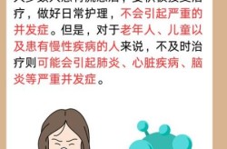 2024最近爆发的流感症状（最近爆发的流感叫什么）