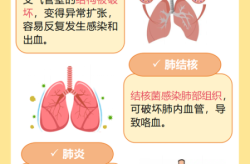 慢阻肺吐血属于晚期吗，慢阻肺咯血是晚期了吗