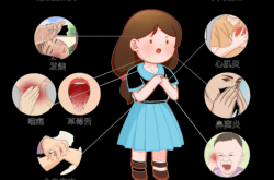 最近小孩流行的病毒叫什么什么症状，儿童病毒感染的症状