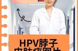 阳性最开始有哪些症状，女性hpv初期症状有哪些