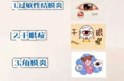 2023第二波疫情红眼病毒，2023年的疫情是什么病毒