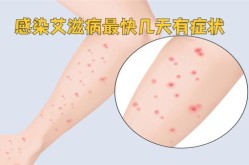 s病毒有什么症状和表现，s病最初是什么症状
