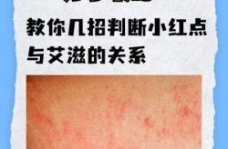 怎么知道自己有性疾病，怎么判断对方有没有性疾病