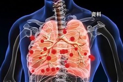 人类偏肺病毒几天能好，偏肺病毒烧了6天了还没好