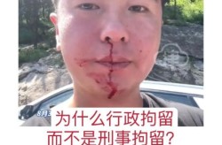 山东通报防疫人员殴打居民，防疫人员与居民互殴如何处理