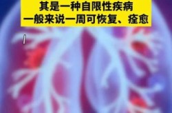 偏肺病毒阳性怎么治疗，人偏肺病毒阳性