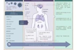 2025年新冠大爆发，新冠2025年5月症状