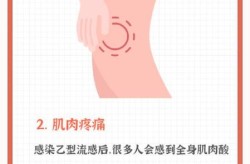 疫情症状初期表现 全身酸痛（浑身酸疼是流感症状吗）