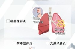 感染性强的病毒有哪些，病毒性传染病有哪些