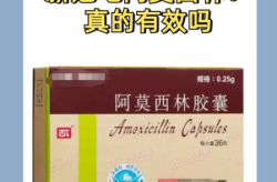 阿莫西林是不是抗生素，阿莫西林是万能消炎药吗