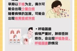 新冠十大症状指的是什么，新冠病十大症状