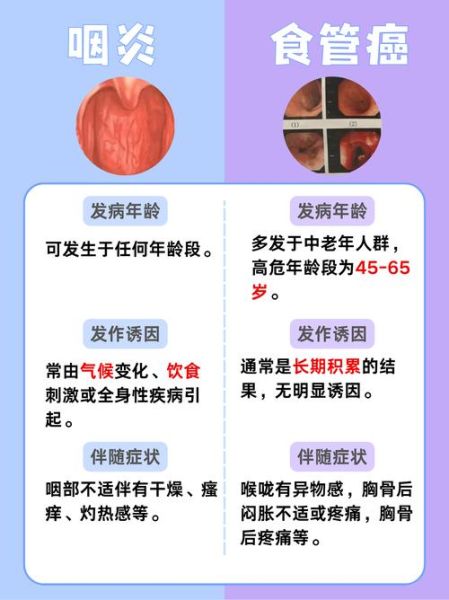 德尔塔病毒症状喉咙不舒服(喉咙不舒服是怎么回事)