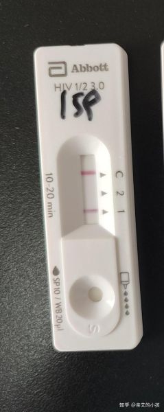 夫妻一个阳性一个阴性正常吗(阴性和阳性哪个是正常)