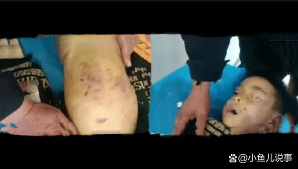 山东男子殴打疫情防控人员致死（山东男子殴打防疫人员致死）