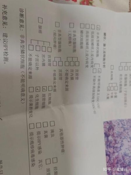 青岛确诊的哥52名密接者均为阴性（hpv23均为阴性是什么意思）