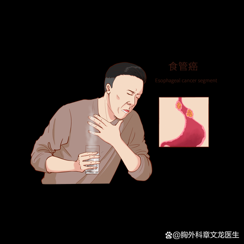肺部感染呕吐怎么回事,怎么判断肺部有呕吐物