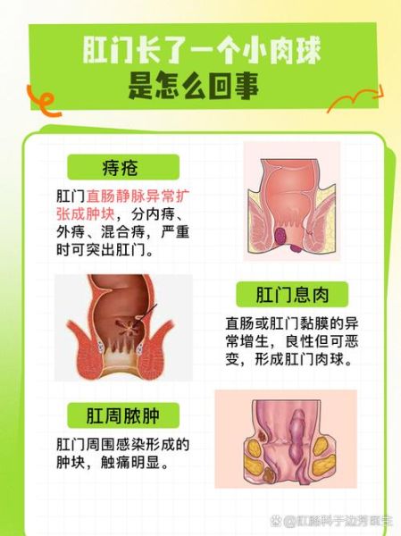 肛门旁边有个肉球突出还疼，肛门突然长个肉球一碰就疼