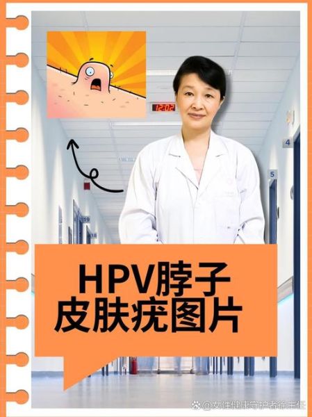 阳性最开始有哪些症状，女性hpv初期症状有哪些