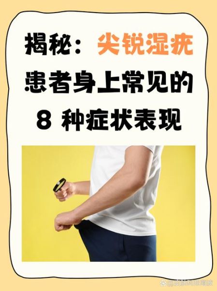 得了性疾病身体有什么症状，女人得了性疾病有哪些症状
