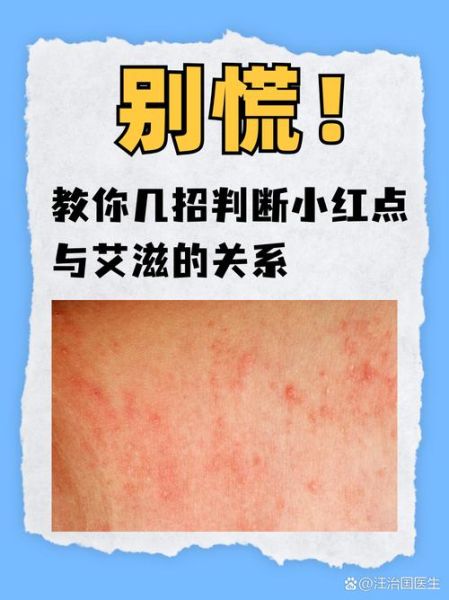 怎么知道自己有性疾病，怎么判断对方有没有性疾病