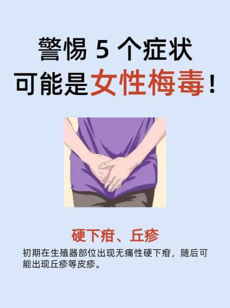 得了性疾病有什么症状，女生得性疾病症状
