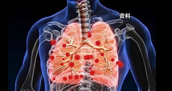 人类偏肺病毒几天能好,偏肺病毒烧了6天了还没好