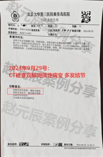 双肺改变间质性严重吗,两肺间质性改变能治愈吗